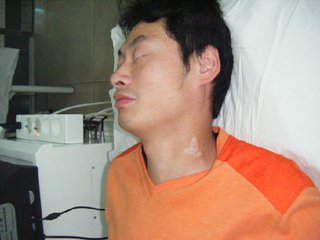 白癜风遗传给下一代的几率大吗?(图1)