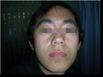 白癜风患者可以多吃哪些食物？(图1)